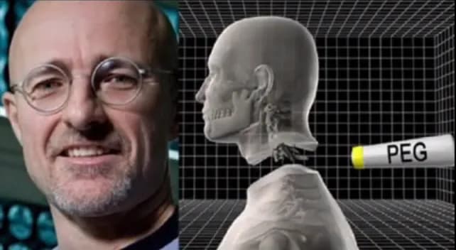 Pierwszy na świecie przeszczep głowy: kontrowersje i naukowe wyzwania